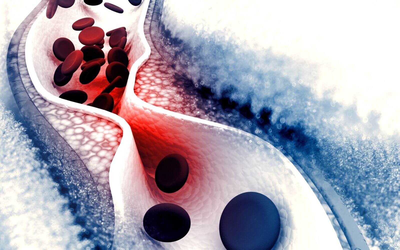 Ezetimibe Uses Dosage Side Effects