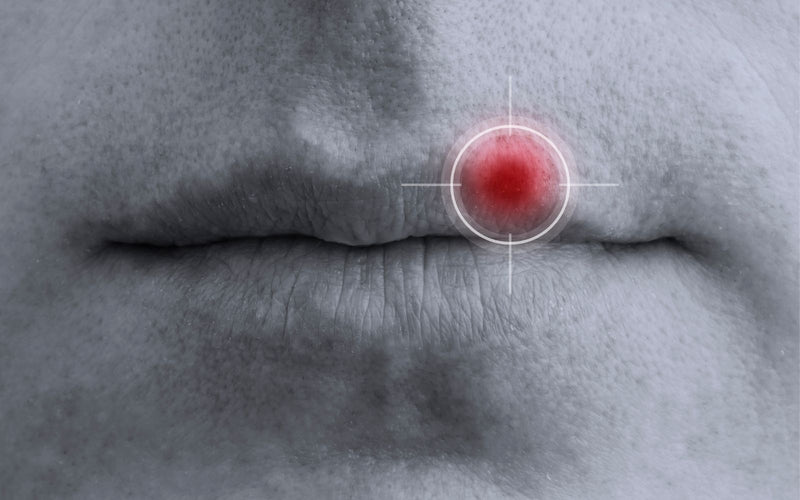 What is Oral Herpes?